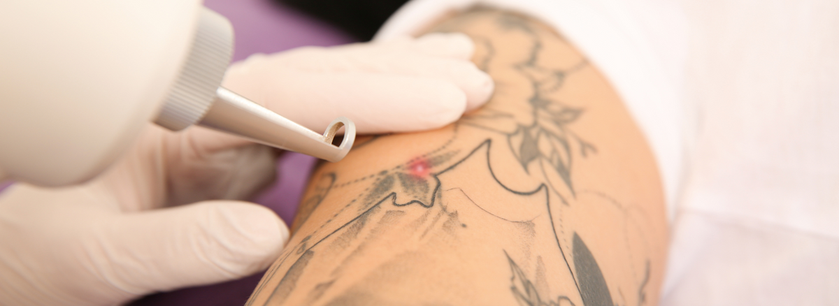 Ink'd London Tattoos Piercings & Laser Tattoo Removal